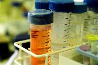 A photograph of some bottles containing various samples.