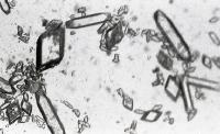 Microscopical images of crystal like structures